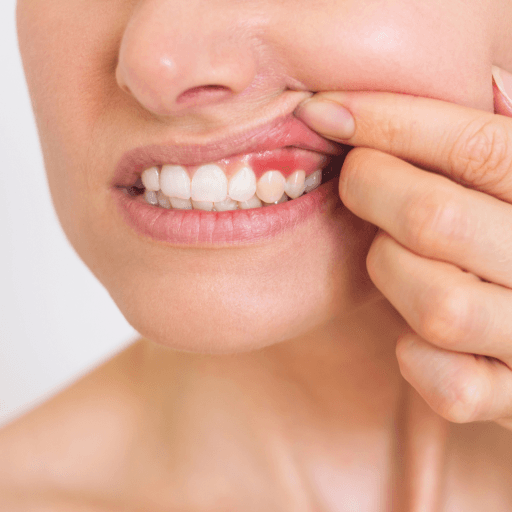 What Are Gingivitis and Periodontal Disease?